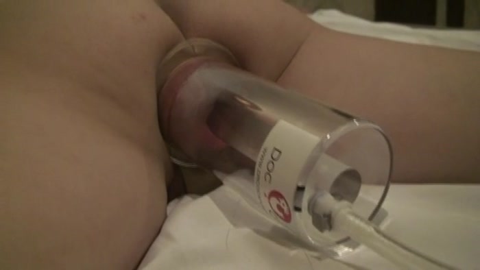 1762 Anal prolapse pump